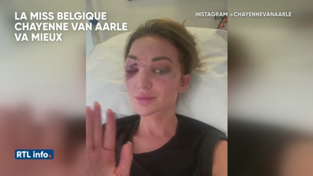 La Miss Belgique 2022 Chayenne Van Aarle pose sur son lit d’hôpital après son grave accident de voiture