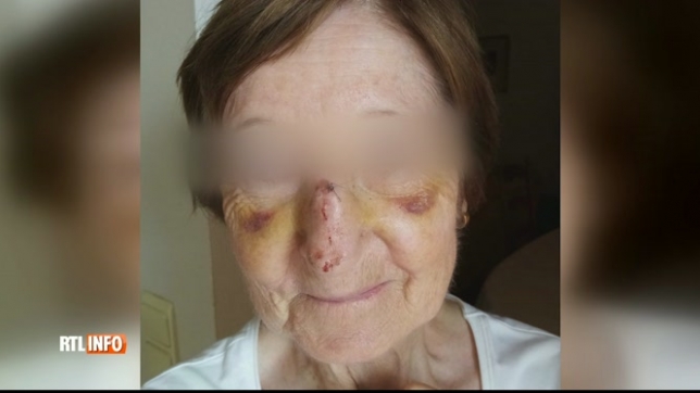 C’est vraiment inacceptable: la maman de Sandra trébuche à cause d’une trottinette mal garée à Bruxelles et finit aux urgences avec le nez fracturé