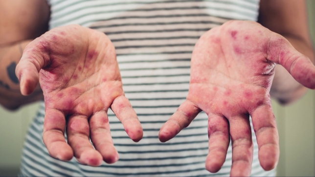 Edition numérique des abonnés