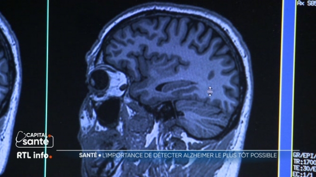 L’Alzheimer touche plus de 200.000 personnes en Belgique