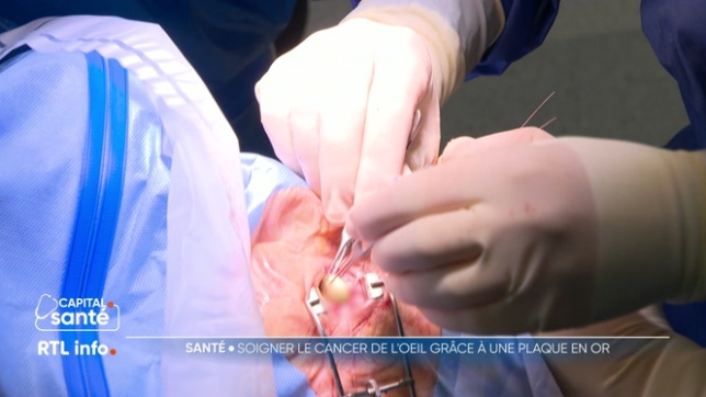 130 Belges sont diagnostiqués en moyenne chaque année en Belgique. Les Cliniques universitaires Saint-Luc proposent un traitement unique en Belgique : la pose d'une plaque en or contenant de l'iode radioactive implantée dans l'oeil pendant 4 jours. Explications.