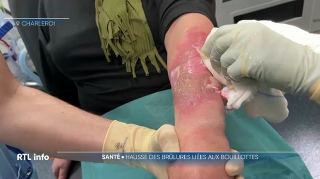 Pour se réchauffer, les bouillottes à l'eau très chaude ou à chauffer au micro-ondes sont à la mode en ce moment. Les urgentistes mettent en garde car il y a énormément de cas de brûlures.