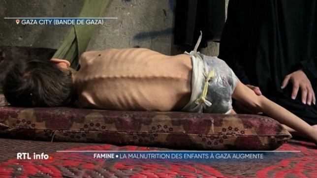 Médecins Sans Frontières confirme la malnutrition infantile dans la bande de Gaza. Les professionnels de la santé souffrent eux-mêmes de la faim. La situation est dramatique.