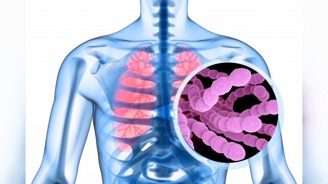 Cette bactérie peut provoquer des maladies graves telles des pneumonies, des méningites et des infections du sang