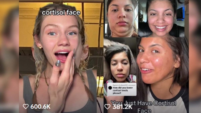 cortisol face.jpg