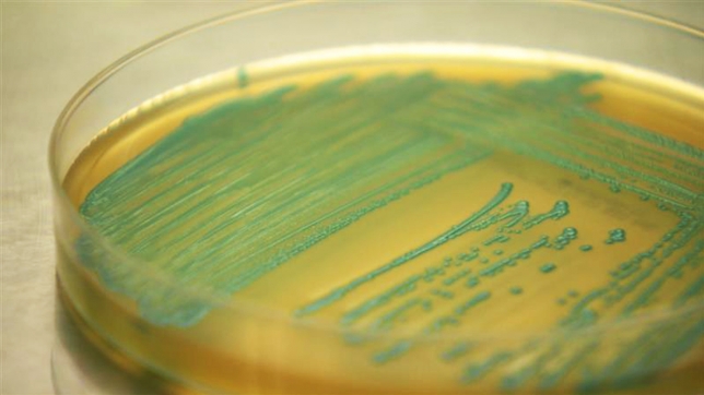 listeria.jpg