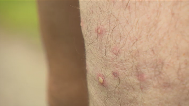 Des marcheurs ont été pris pour cible par deux nids de frelons, ce dimanche, à Nassogne. Les pompiers sont intervenus pour détruire les nids, une pratique de plus en plus courante.