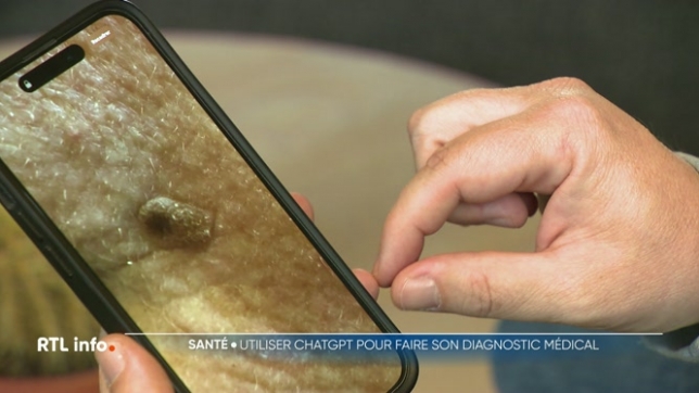 L'intelligence artificielle s'impose de plus en plus dans notre quotidien, y compris quand il est question de santé. Vous êtes nombreux, par exemple, à demander à Chat GPT un diagnostic après avoir exposé vos symptômes. Mais le résultat est-il fiable ? Nous avons fait le test pour vous.