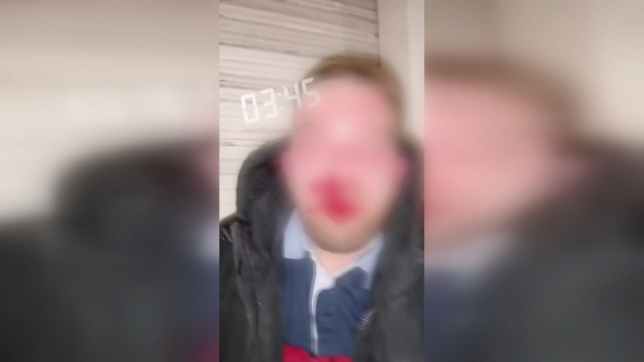 L’un des suspects s’en est pris sans raison apparente à un jeune homme