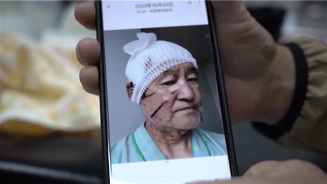 Le Japon fait face à une situation inédite dans le pays : les attaques d’ours atteignent un nombre record. Plus de 20 000 signalements d’ours ont été enregistrés en six mois. Les autorités japonaises sont démunies et ont même déployé les forces de l’armée pour faire face à ce phénomène.