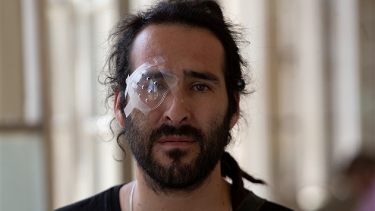 belgaimage-158220296