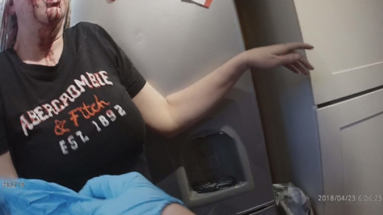 Mon copain vient de me frapper: la police arrive chez une femme victime de violences conjugales dont le visage est ensanglanté