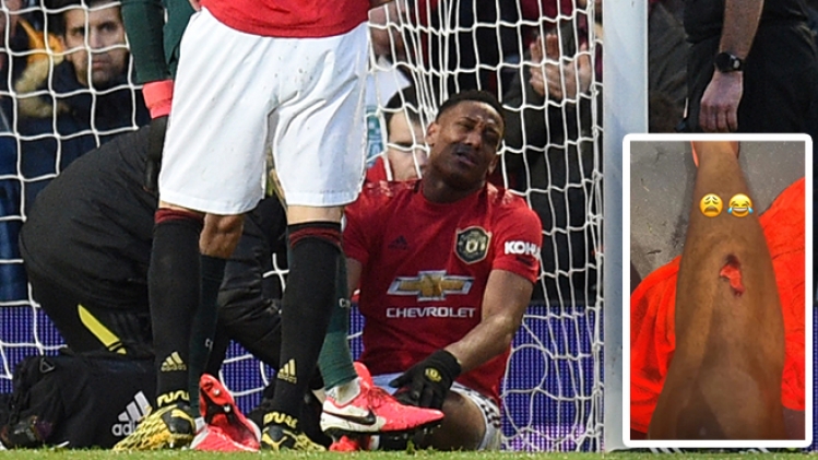 BELGAIMAGE-162330464