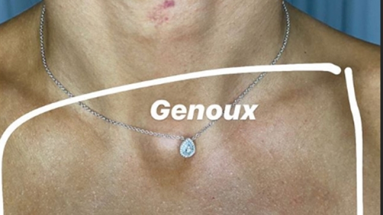 genoux