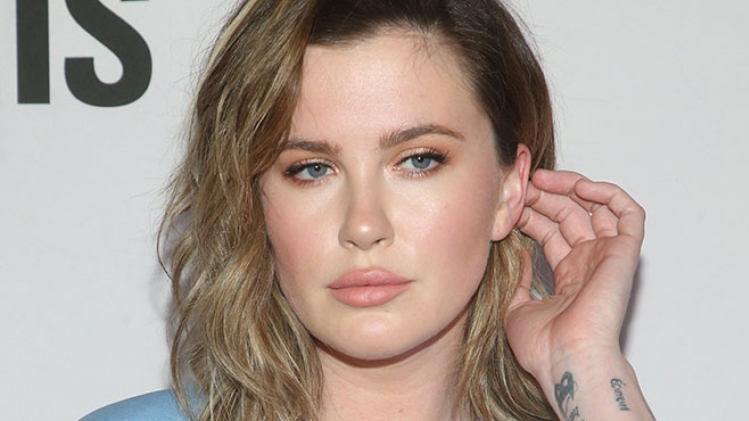 isopix_irelandbaldwin