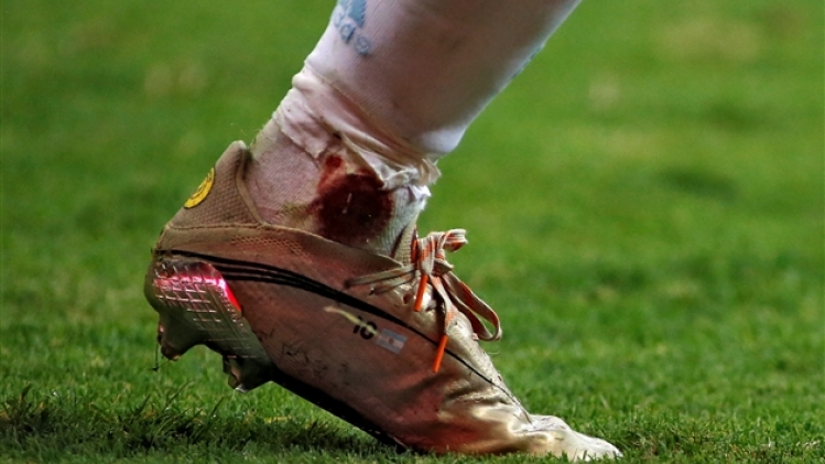 belgaimage-178455674 (1)