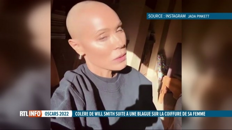 Santé: qu'est ce que l'alopécie? la maladie dont souffre Jada Pinkett Smith