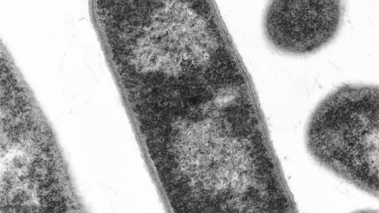 Près de 70 cas de botulisme en Europe après un traitement médical en Turquie