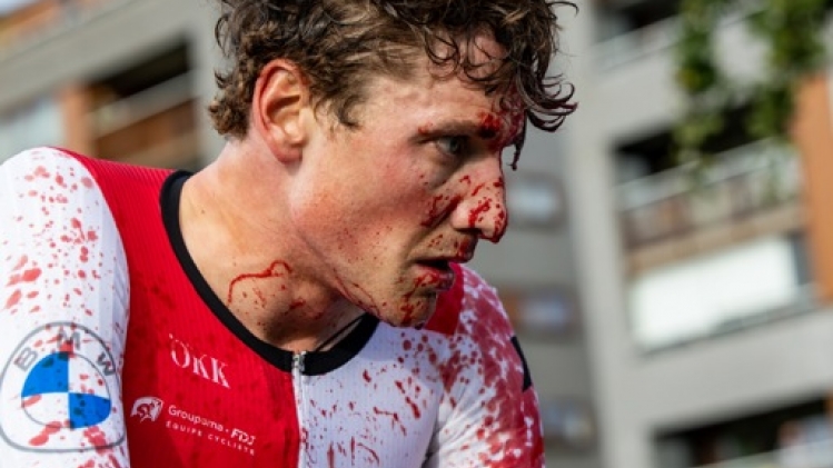 Commotion, fractures au visage et à la main pour Stefan Küng