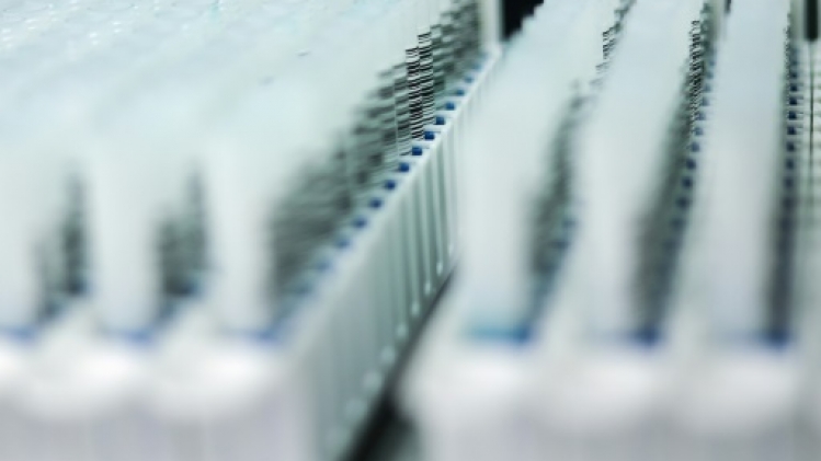 Endométriose: un test salivaire prometteur devrait bientôt être disponible