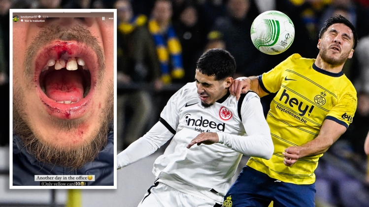 belgaimage-85746140_copie