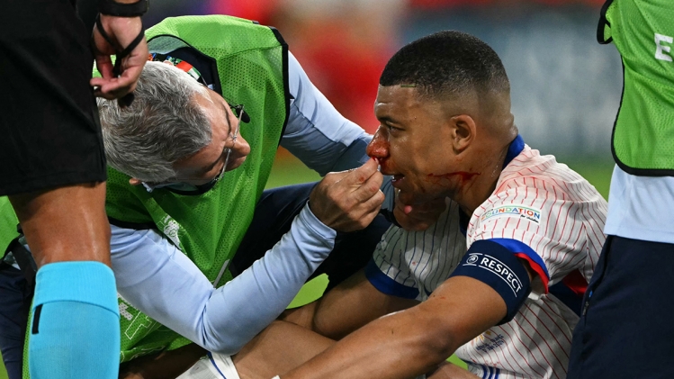 belgaimage-94764611_copie