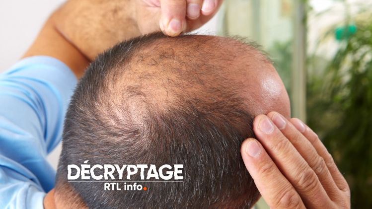 decryptage calvitie