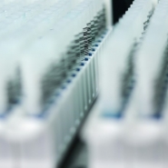 Endométriose: un test salivaire prometteur devrait bientôt être disponible