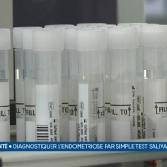 Le laboratoire Ziwig Lab, installé à Tercis-les-Bains, est équipé de robots dernier cri permettant d'analyser plusieurs milliers de prélèvements chaque semaine. Les tests détectent l'endométriose par la salive grâce à l'analyse et au séquençage de l'ARN. Explications.