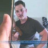 Le week-end dernier, au festival de Dour, une bonbonne de gaz a explosé au niveau du camping réservé aux bénévoles. Trois personnes ont été blessées lors de l'explosion, dont deux présentant de graves brûlures ont été évacués vers des hôpitaux. C'est le cas de Corentin.