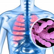 Cette bactérie peut provoquer des maladies graves telles des pneumonies, des méningites et des infections du sang
