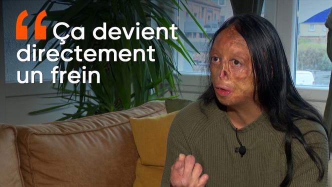 handicape-discrimination-physique