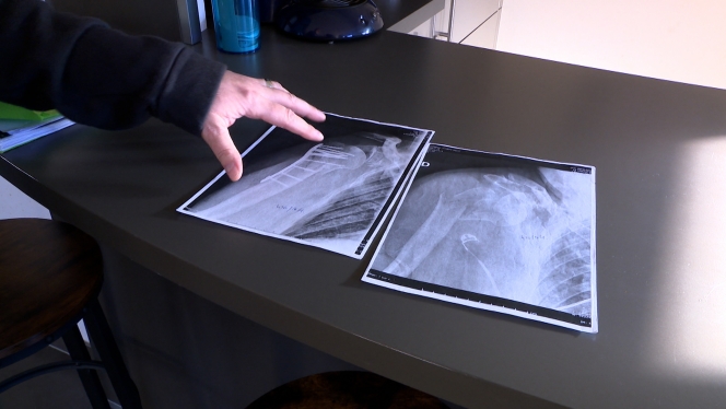 tan_refugier_temoins_fdh_gli