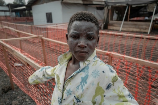 Mpox: les premières recommandations de l'OMS attendues prochainement