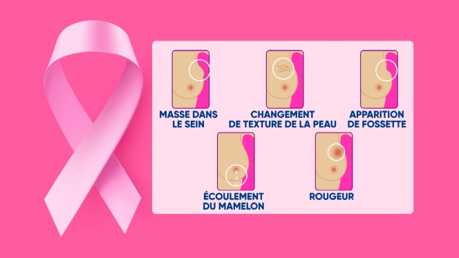 cancer du sein