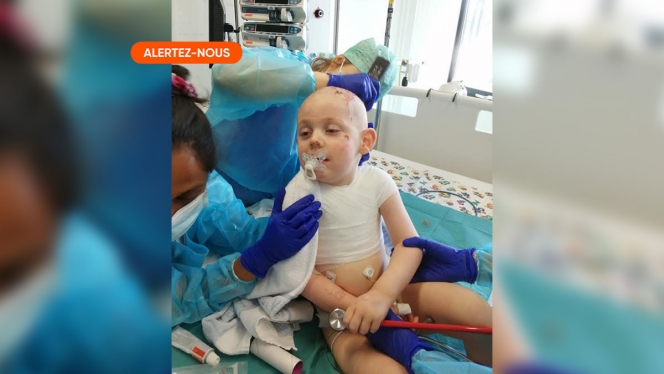 Samuel brûlé au troisième degré 